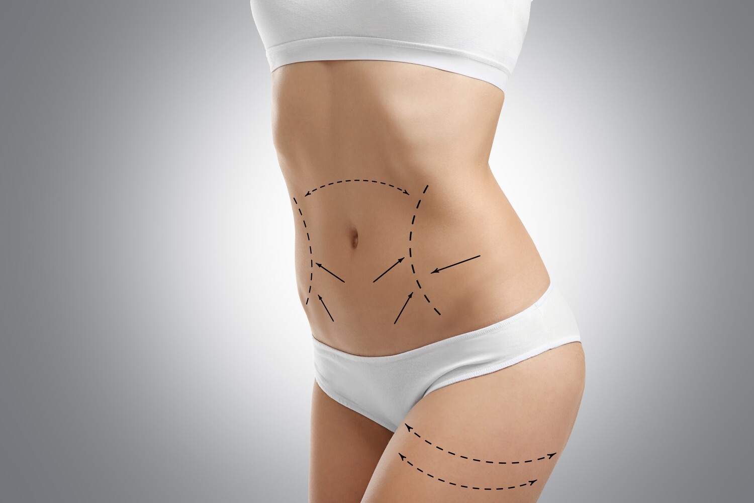 Liposuction understanding techniques and patient experience